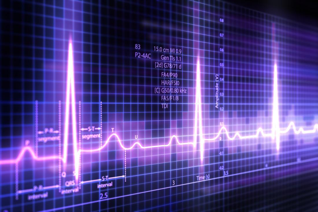Best ECG Test Centre in Delhi