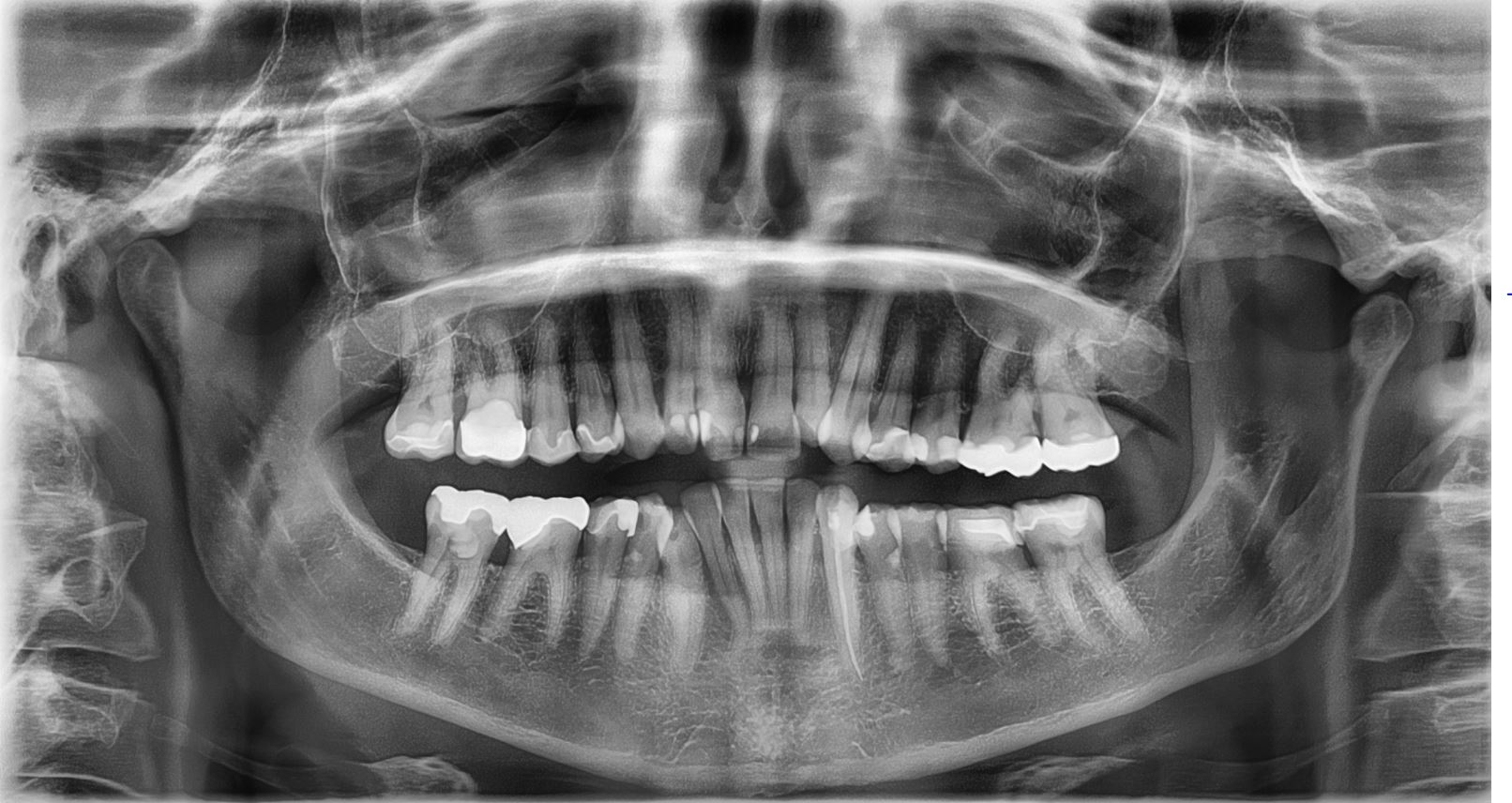 Best Dental X-Ray Centre in Delhi, Best OPG Centre in Delhi